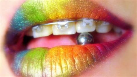 beso arcoitis|¿Qué es el beso arcoiris y cuáles son los riesgos de。